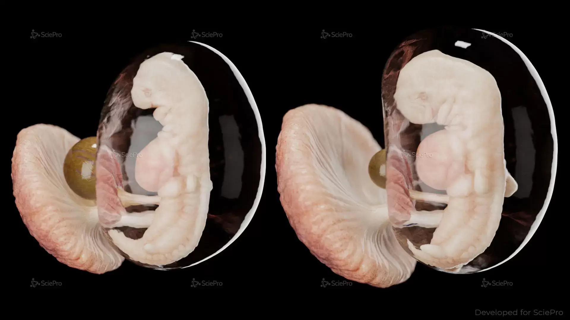 Week 6 & 7 Fetal Development Model